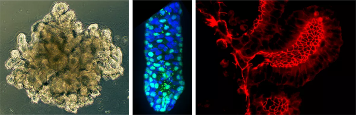 intestinal organoids